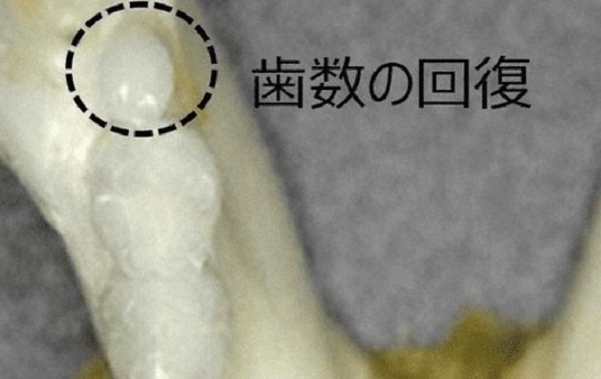 В Японії вчені заново відростили зуби