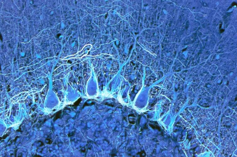 Вчені розробили деталізовану мапу людського мозку