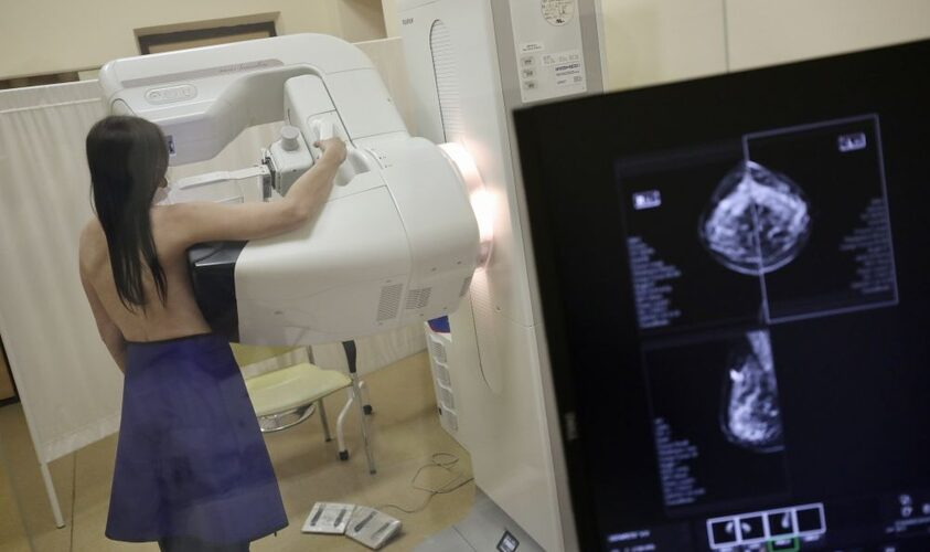 У Луцьку безоплатно робитимуть мамографію: де й коли