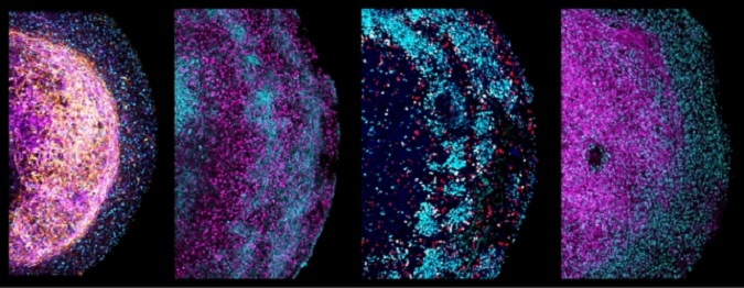 Учені вперше створили мозковий органоїд з тканин мозку плода (фото)