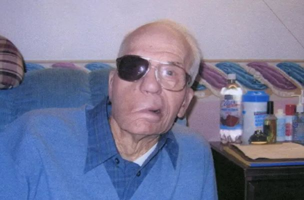 Чоловік, якому в дитинстві брат вистрелив в обличчя, прожив 94 роки