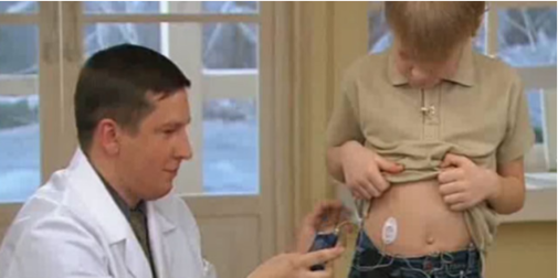 У Луцьку просять виділити кошти на купівлю інсулінових помп для дітей з діабетом